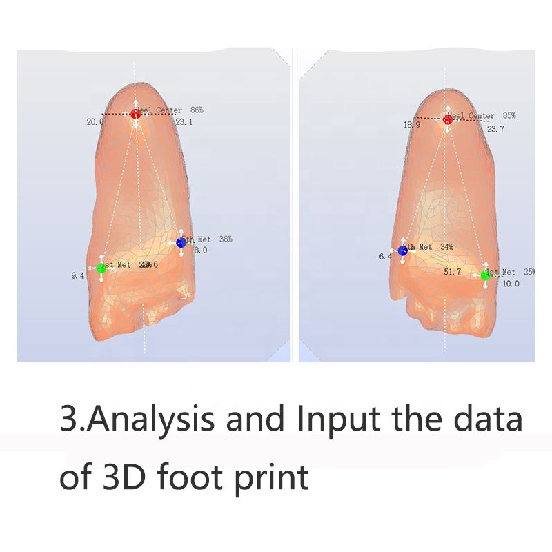 XD-3D 3D Footprint Arch Support Custom Scanned Insoles - Personalized Orthotic Insole | Jinjiang Xin