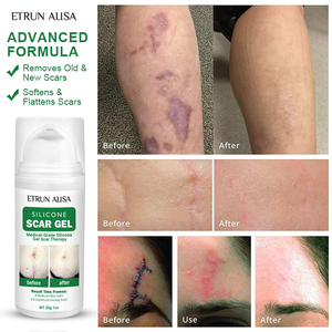 ETRUN ALISA Marque privée <span class=keywords><strong>Gel</strong></span> en <span class=keywords><strong>silicone</strong></span> pour enlever les cicatrices anciennes et nouvelles cicatrices d'acné <span class=keywords><strong>Gel</strong></span> topique lisse pour éliminer l'acné pour les soins de la peau - Product Image 6