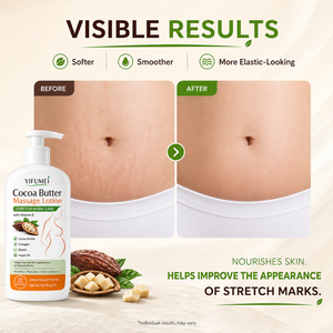 Lotion corporelle <span class=keywords><strong>anti</strong></span>-vergetures raffermissante et hydratante pour une peau élastique et lisse, soin du ventre, des cuisses et des hanches - Product Image 5