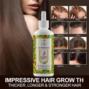 Organic Essential Oil Treatment Products Private Label Hair Care Hair Loss Treatments For Hair Growth Men And Women