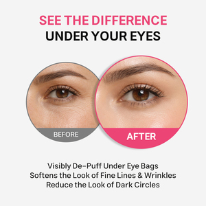 Masque pour les yeux en gelée rose OEM personnalisé au PDRN, collagène et NAD avec logo en relief pour le soin des yeux, anti-poches, éclaircissant et raffermissant – Produits de soin de la peau - Product Image 5