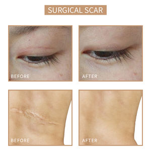 <span class=keywords><strong>Micropigmentación</strong></span> Cicatriz Cubierta Estrías Pigmentos de camuflaje con cobertura de vitiligo - Product Image 4