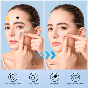 แผ่นแปะสิว Hangu OEM รูปดาวน่ารัก ช่วยลดรอยสิวและบรรเทาอาการลึก - Product Image 5