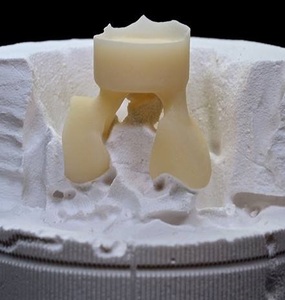 Bloques de Zirconia Multicapa Súper Translúcidos a Todo Color para Laboratorio Dental, Maquinaria de Sistema <span class=keywords><strong>CAD</strong></span>/CAM, Certificación CE - Product Image 6