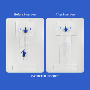 Стерильный одноразовый медицинский перевязочный карман для диализного катетера на нетканых материалах - Product Image 4