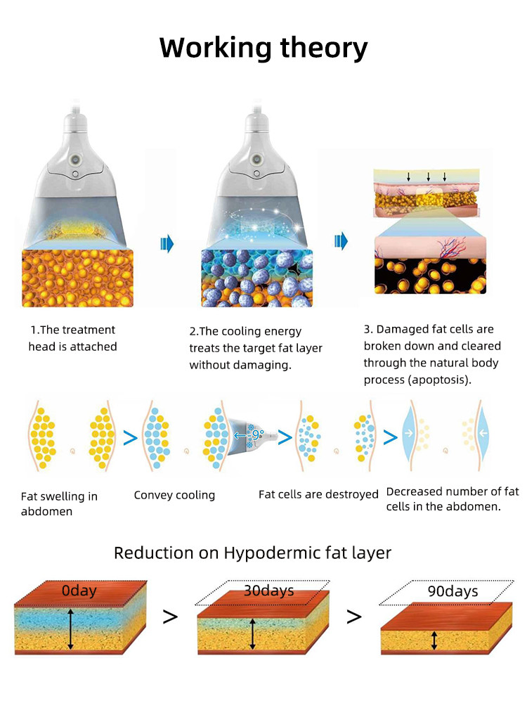 HOT Sales Cryotherapy machine 360 cooling technology Non-invasive fat reduction any treatment area at any angle