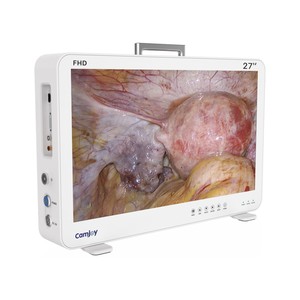 Sistema de Cámara Endoscópica Multifuncional Camjoy para ORL, Laparoscopia y Cistoscopia, Alta Definición y Portátil - Product Image 4