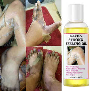 Olio Esfoliante Extra Forte Mooyam, Correttore e Rimuovi Pelle Morta, Altamente Efficace per lo Sbiancamento delle Nocche, Olio Esfoliante Potente - Product Image 2
