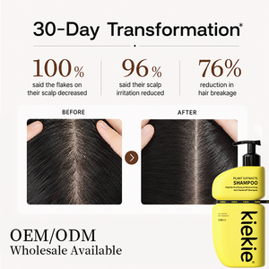 Shampooing Antichute et Antipelliculaire à l'Octenidine et Polypeptide – Traitement du Cuir Chevelu – Soulagement Longue Durée des Démangeaisons – Contrôle des Pellicules – 500ml - Product Image 5