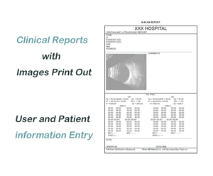 เครื่องอัลตราซาวนด์ตรวจตา ABS-300 A/B พร้อมหัวตรวจ 10MHz, สูตร IOL, โหมด Immersion/Contact สำหรับ<span class=keywords><strong>ค</strong></span>ลินิกจักษุ - Product Image 5