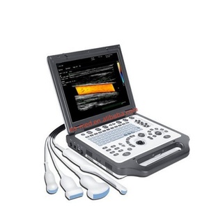 Meilleures ventes : Appareil d'échographie portable pas cher, scanner ultrasonore Doppler couleur CU30 - Product Image 2