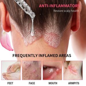 Aceite de Rosa multifunción orgánico Natural de etiqueta privada para el cuidado del cuerpo y el suero para el cuidado del cabello para aceite esencial de Rosa hidratante OEM - Product Image 6