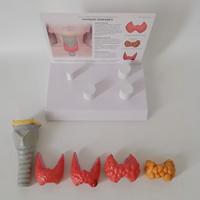 Modèle anatomique de la glande thyroïde humaine avec 4 étapes pathologiques pour l'enseignement en endocrinologie