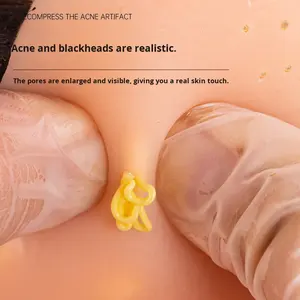 Giocattolo Antistress Realistico per Spremere Brufoli, Modello Testa Grande, Estrattore di Acne, Spingi-Punti Neri, in Plastica, per Ansia e Depressione - Product Image 5