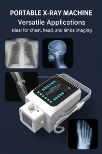 Fournisseur portatif de machine de rayon X pour l'équipement d'hôpital équipement médical mobile de rayon X 5.6kw équipement numérique de rayon X de haute énergie de machine de rayon X - Product Image 2