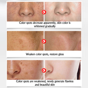 Crema Aclaradora de Pecas OEM de 7 Días, Elimina la Melanina, Pecas, Manchas Oscuras, Crema Blanqueadora Facial para Piel Negra - Product Image 4