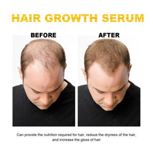 Aceite orgánico natural 100% para hombres y mujeres, potenciador del bienestar del cabello con fórmula concentrada, promueve el resplandor del cabello y la piel - Product Image 5