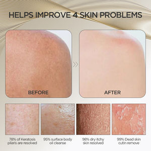 Prix usine en gros vente chaude corps brosse à récurer exfoliant dos éponge serviette enlever faux bronzage - Product Image 3