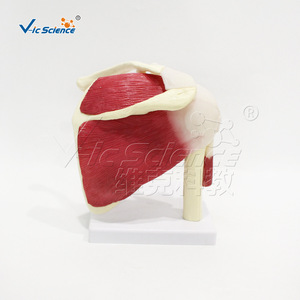 Modèle médical de l'articulation de l'épaule avec muscles et ligaments ; démonstration de l'atteinte de la coiffe des rotateurs ; enseignement et formation en réadaptation - Product Image 1