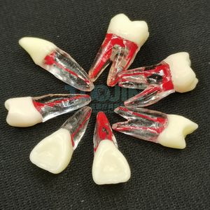 Educatieve Leverancier Tandheelkundige Endo Tanden Wortelpraktijk Tand Dentale Endodontische Tand <span class=keywords><strong>Model</strong></span> Met Gekleurde Wortel En Pulp - Product Image 2