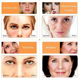 เซรั่มวิตามินซีชะลอวัยลดริ้วรอยจุดสว่างตอนเช้ามอยส์เจอร์ไรเซอร์ทำให้ผิวขาวติดป้ายตามต้องการ - Product Image 5