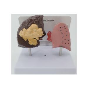 Modelo de patología pulmonar humana para ciencias médicas: modelo de enfermedad pulmonar, modelo de enfermedad orgánica, modelo antidrogas - Product Image 1
