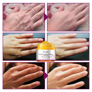 RtopR maschera per la cura delle mani di Mango biologico sbiancante idratante riparazione esfoliante cura della pelle e Anti-invecchiamento caratteristiche - Product Image 5