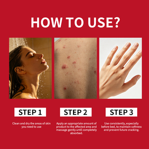 Crema de Alta Calidad para el Cuidado de la Piel Sensible con Problemas de Dermatitis, Psoriasis y Eccema, Nutritiva y Calmante - Product Image 5