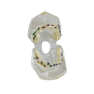 Modelo <span class=keywords><strong>de</strong></span> ortodoncia para entrenamiento Dental, modelo tipodot con soporte <span class=keywords><strong>de</strong></span> Metal transparente para la comunicación <span class=keywords><strong>de</strong></span> los pacientes - Product Image 1