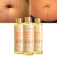 Huile Anti-Vergetures Marque Blanche OEM/ODM, Soin Hydratant et Réparateur, Huile Corporelle Raffermissante de Massage
