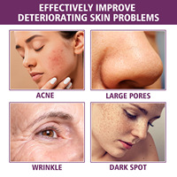 Niacinamide Vitamine C Anti-rides Hydratant Élastifiant pour le Visage Soin Liquide Éclat Illuminateur Taches Pores Délicats