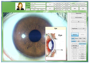 Máquina Analisadora De Saúde Câmeras Digitais Chinesas Máquina Analisadora De Saúde Analisador De Pele - Product Image 3