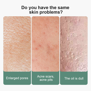 Certificado GMP OEM todo en uno tónico <span class=keywords><strong>facial</strong></span> microbioma equilibrio Lactococcus fermento lisado hierba orgánica Mineral fórmula líquida - Product Image 5