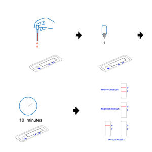 Medizinische Produkte Hochempfindlicher Hepatitis-C-Virus-Antikörper-Test Anti-HCV Schnelltest-Kit Klasse II 1 Jahr Garantie - Product Image 4