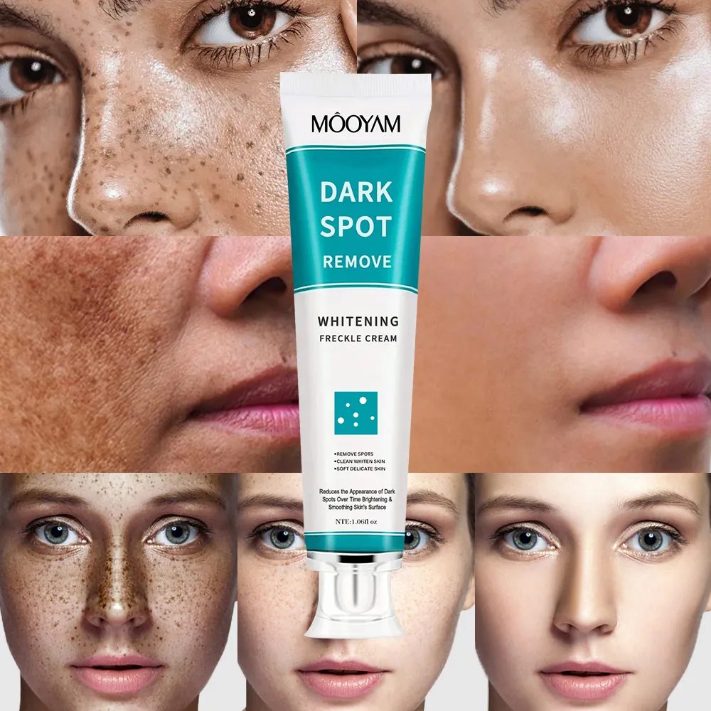 Crema facial para el cuidado de la piel, crema blanqueadora profunda de marca privada, elimina el Melasma, manchas oscuras, melanina, brillante, antienvejecimiento