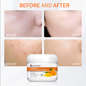 ครีมขมิ้นไนอาซินาไมด์ช่วยเพิ่มความขาวให้ผิวเพิ่มความชุ่มชื้นให้ผิวครีมบำรุงผิววีแกนออร์แกนิกเครื่องสำอางฮาลาล - Product Image 5