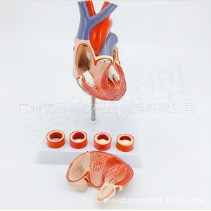 Stent cardiaque, bypass des artères coronaires, chirurgie ouverte de la valve cardiaque, thrombose humaine, démonstration de la structure cardiaque et vasculaire - Product Image 3