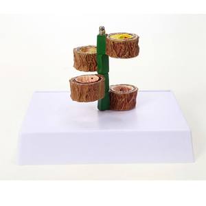 Modelo vascular humano anatómico de cuatro etapas para la ciencia médica que ilustra la <span class=keywords><strong>arteriosclerosis</strong></span> y la <span class=keywords><strong>enfermedad</strong></span> vascular - Product Image 5