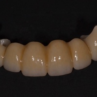 Bloc de zircone céramique dentaire multicouche 3D Pro à haute translucidité pour la restauration de couronnes, bridges et facettes en laboratoire dentaire