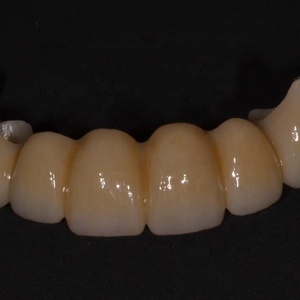 Bloc de zircone céramique dentaire multicouche 3D Pro à haute translucidité pour la restauration de couronnes, bridges et facettes en laboratoire dentaire - Product Image 3