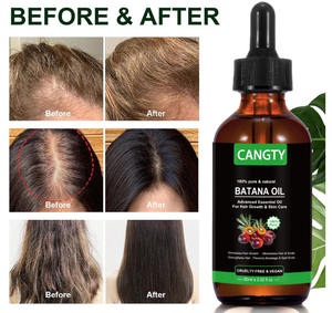 Dầu Rosemary Batana kích thích mọc tóc nhãn hiệu riêng - Product Image 6