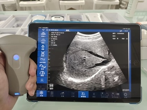 Échographe Doppler Couleur Portable Sans Fil à Sonde Convexe Personnalisable pour la Grossesse - Product Image 2
