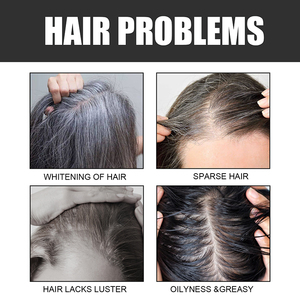 Commercio all'ingrosso barra di pulizia di controllo olio <span class=keywords><strong>barba</strong></span> crescita capelli neri Shampoo <span class=keywords><strong>sapone</strong></span> per la crescita dei capelli per gli uomini - Product Image 3