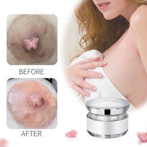 Crema Blanqueadora para Zonas Íntimas, Crema para Pezones Rosados - Product Image 2