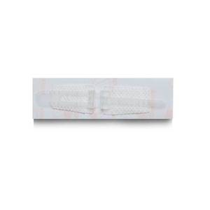 Steri Strips Skin Tone Wound Closure Tape Non-Woven Fabric Medical Adhesive For Wound Fixation - Product Image 3