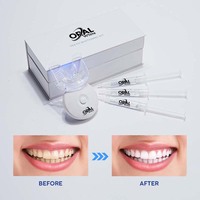 Pemutihan Gigi Lengkap dengan Layanan Khusus, Dilengkapi Lampu LED Pemutih Gigi Trendi dan Stylish dengan Logo