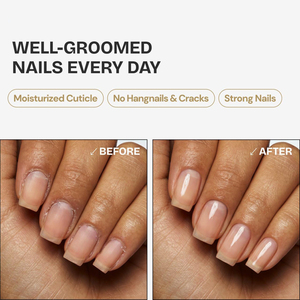 Travel-Sized Cuticle Oil <b>Pen</b> Custom Logo Silver Nail Treatment Care <b>Pens</b> With <b>Box</b> Repair Vitamin E Wholesale - Product Image 5
