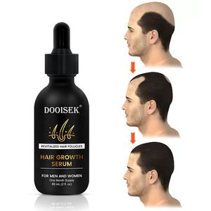 Suero para el cabello Tratamiento reparador para el cuidado del cuero cabelludo Tratamiento antipérdida de cabello Nuevo aceite esencial orgánico para el crecimiento del cabello para mujeres y hombres - Product Image 1