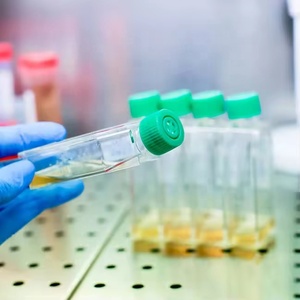 Laboratorio desechable estéril T25 T75 T175 Cultivo celular Frasco de plástico Cultivo de tejidos - Product Image 1