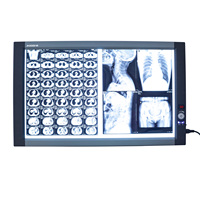 Négatoscope LED Médical Réglable pour Radiographie Panoramique, Visionneuse de Films et Box Lumineux Double Panneau